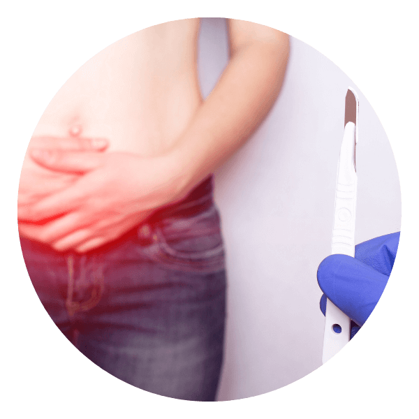 Plastia inguinal, umbilical y abdominal con malla